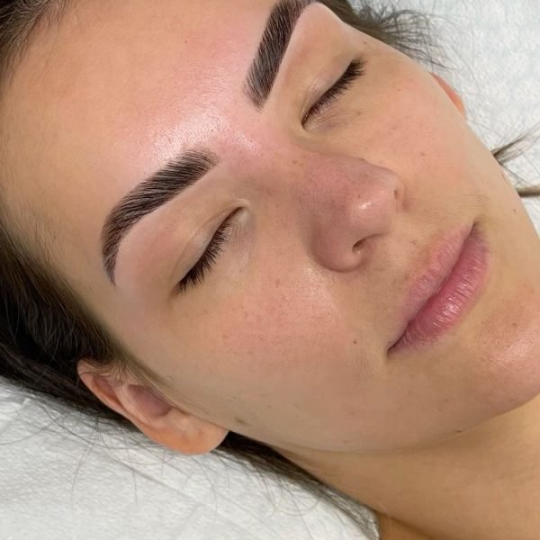 Brow rehabilitation