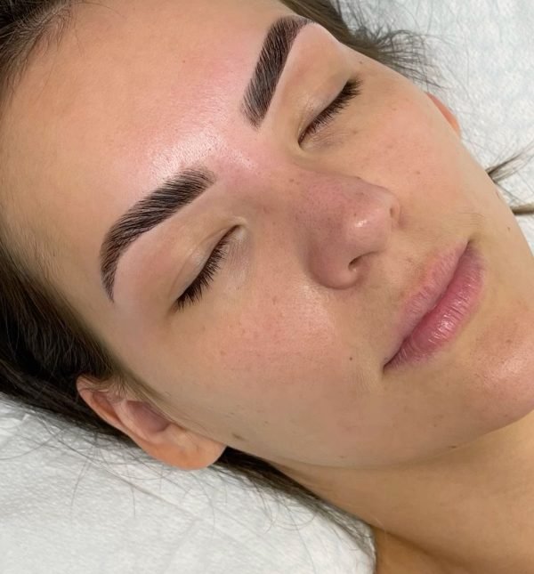 Brow rehabilitation